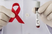 Revelan que más del 4 % de los test de VIH realizados en 2022 por AHF Argentina, resultaron positivos