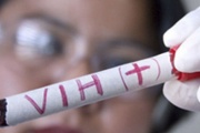 Más de 140 mil personas viven con VIH en el país