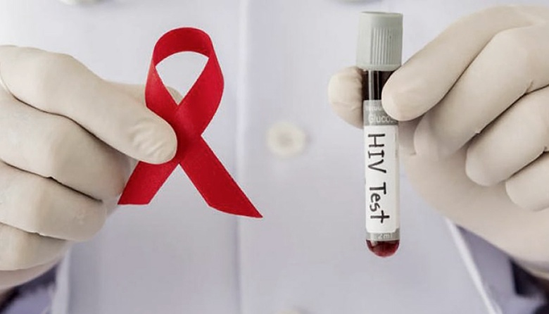 Revelan que más del 4 % de los test de VIH realizados en 2022 por AHF Argentina, resultaron positivos
