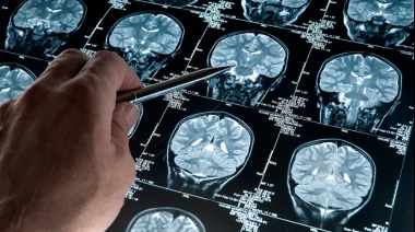 Un software argentino podría diagnosticar de forma precoz el Alzheimer