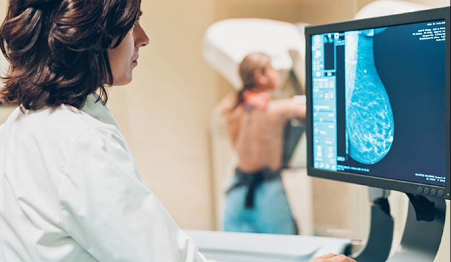 Investigadores de Tandil desarrollaron un prototipo de mamógrafo que no utiliza rayos X - Infogei